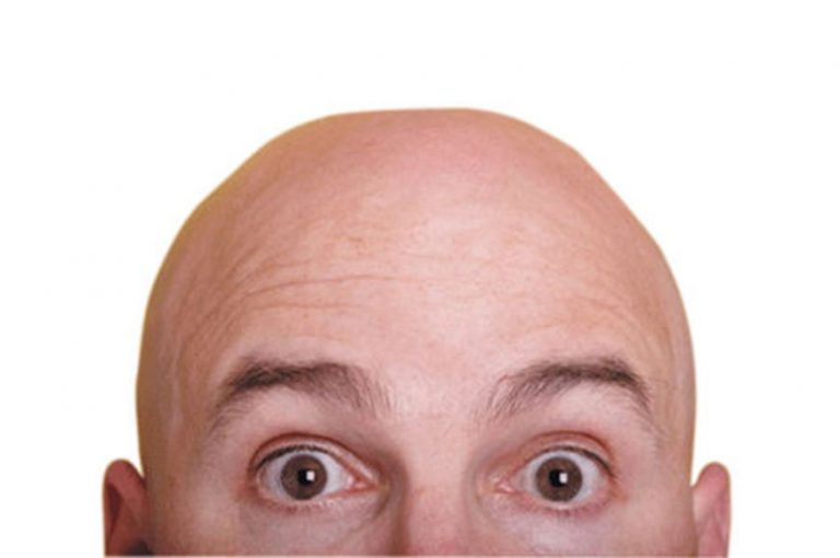 Aplicativo que deixa a foto careca