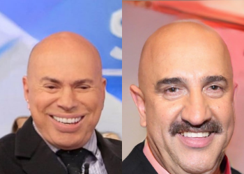 filtro que deixa você careca